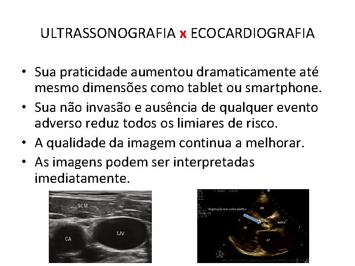 ULTRASSONOGRAFIA x ECOCARDIOGRAFIA • Sua praticidade aumentou dramaticamente até mesmo dimensões como tablet ou