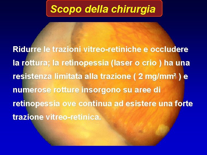 Scopo della chirurgia Ridurre le trazioni vitreo-retiniche e occludere la rottura; la retinopessia (laser