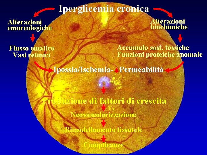 Iperglicemia cronica Alterazioni biochimiche Alterazioni emoreologiche Flusso ematico Vasi retinici Accumulo sost. tossiche Funzioni