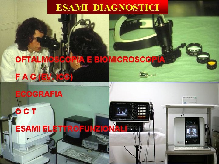 ESAMI DIAGNOSTICI OFTALMOSCOPIA E BIOMICROSCOPIA F A G (EV. ICG) ECOGRAFIA OCT ESAMI ELETTROFUNZIONALI