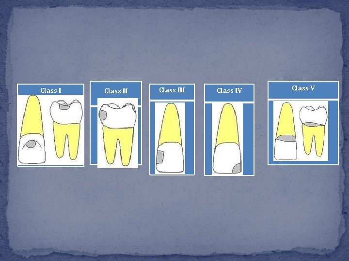 Class III Class IV Class V Class III Class IV Class V
