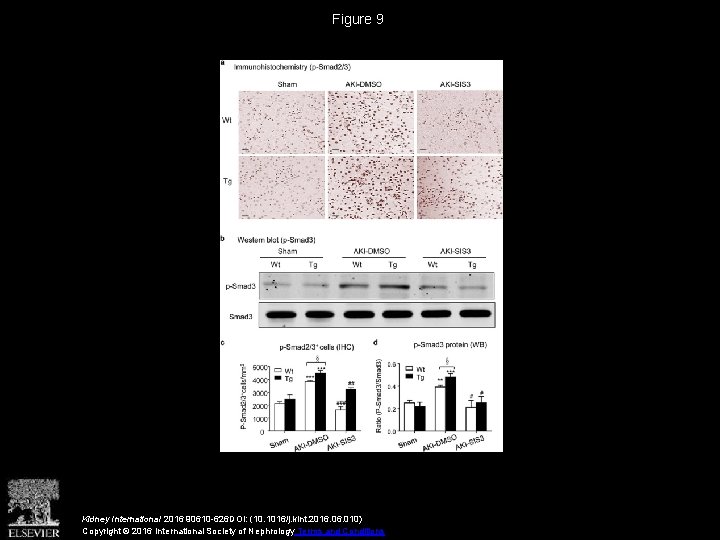 Figure 9 Kidney International 2016 90610 -626 DOI: (10. 1016/j. kint. 2016. 010) Copyright