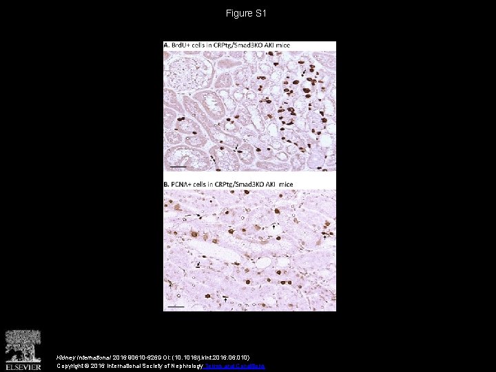 Figure S 1 Kidney International 2016 90610 -626 DOI: (10. 1016/j. kint. 2016. 010)