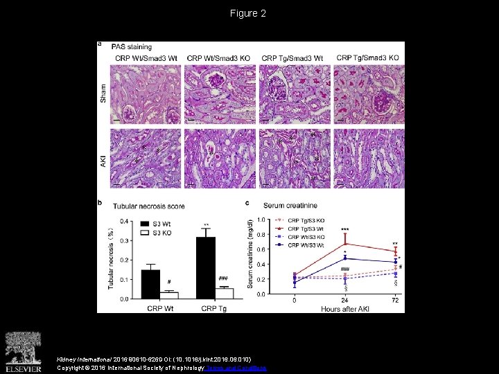 Figure 2 Kidney International 2016 90610 -626 DOI: (10. 1016/j. kint. 2016. 010) Copyright