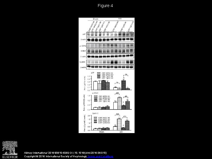 Figure 4 Kidney International 2016 90610 -626 DOI: (10. 1016/j. kint. 2016. 010) Copyright