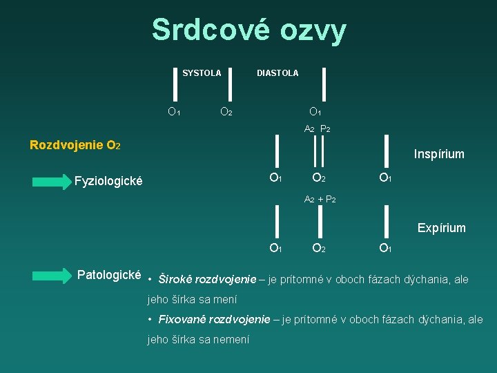 Srdcové ozvy SYSTOLA O 1 DIASTOLA O 2 O 1 A 2 P 2