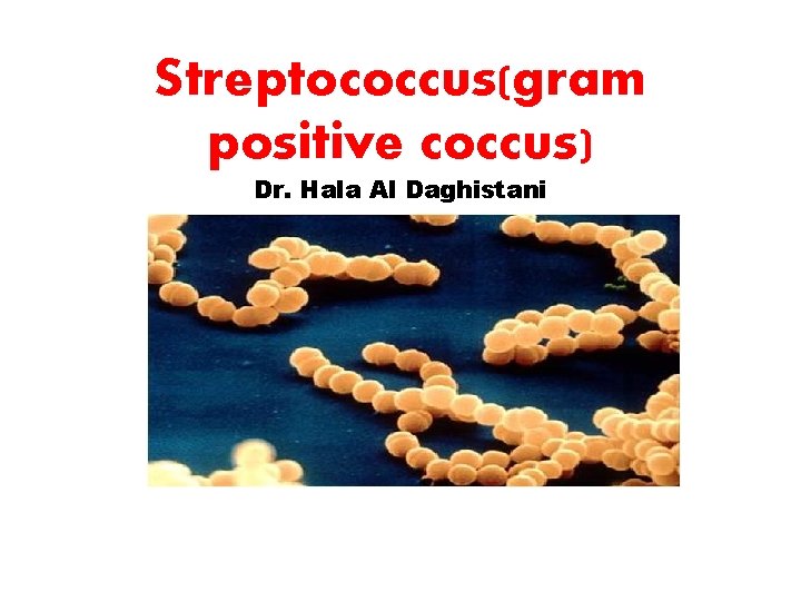 Streptococcus(gram positive coccus) Dr. Hala Al Daghistani 