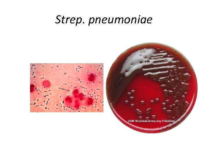 Strep. pneumoniae 