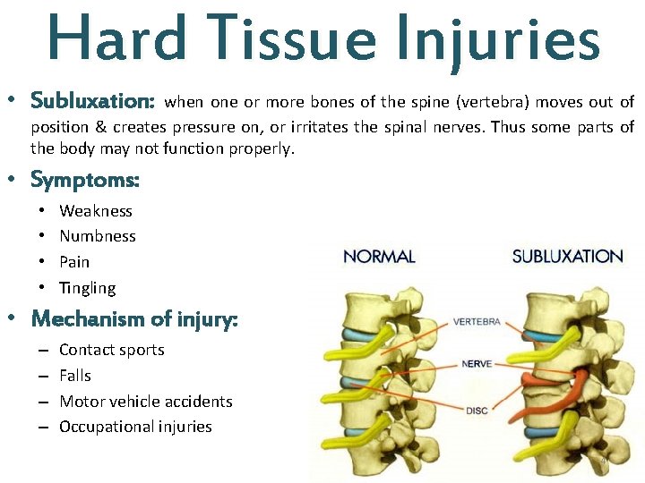 Hard Tissue Injuries • Subluxation: when one or more bones of the spine (vertebra)