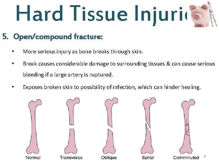 Hard Tissue Injuries 5. Open/compound fracture: • More serious injury as bone breaks through