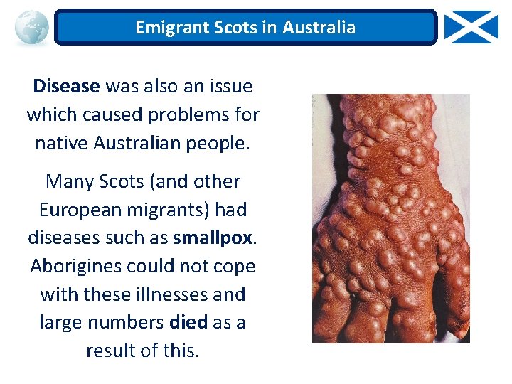 Emigrant Scots in Australia Disease was also an issue which caused problems for native