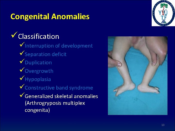 Congenital Anomalies üClassification üInterruption of development üSeparation deficit üDuplication üOvergrowth üHypoplasia üConstructive band syndrome