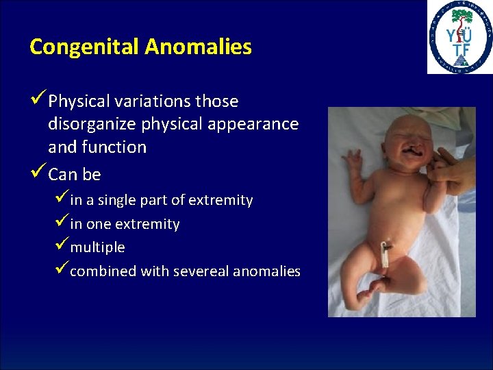 Congenital Anomalies üPhysical variations those disorganize physical appearance and function üCan be üin a