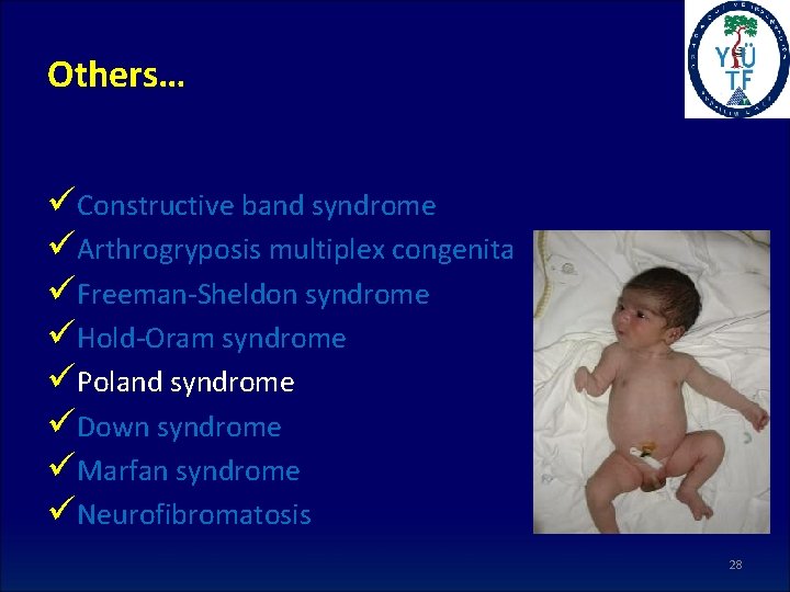 Others… üConstructive band syndrome üArthrogryposis multiplex congenita üFreeman-Sheldon syndrome üHold-Oram syndrome üPoland syndrome üDown