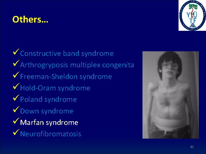 Others… üConstructive band syndrome üArthrogryposis multiplex congenita üFreeman-Sheldon syndrome üHold-Oram syndrome üPoland syndrome üDown