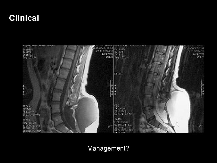 Clinical Management? 