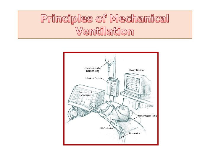 Principles of Mechanical Ventilation 