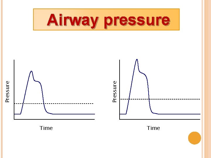 Pressure Airway pressure Time 