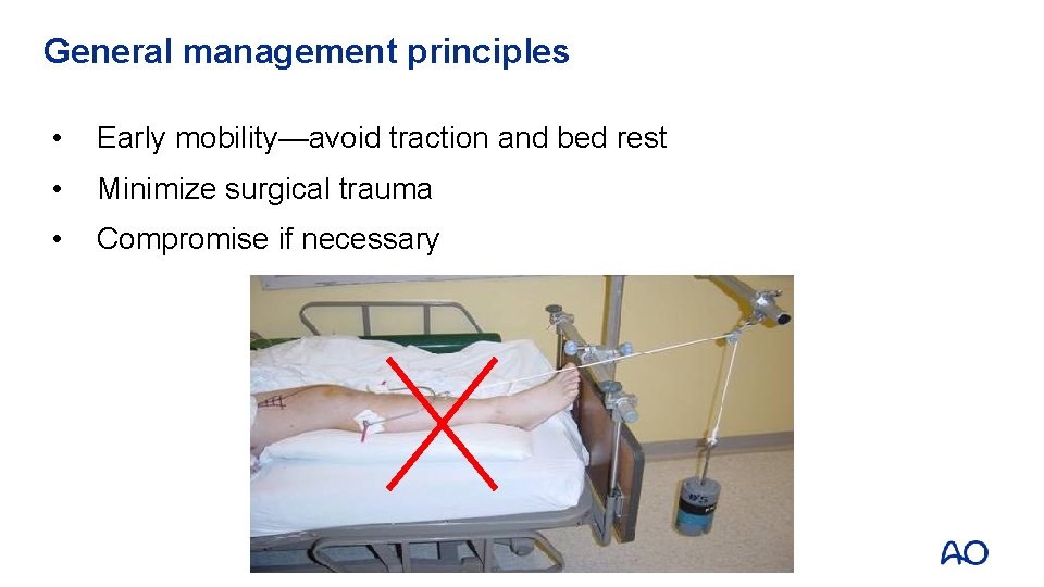 General management principles • Early mobility—avoid traction and bed rest • Minimize surgical trauma