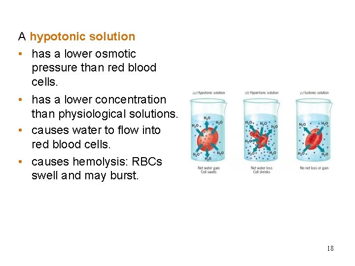 Hypotonic Solutions A hypotonic solution • has a lower osmotic pressure than red blood Hypotonic Solutions A hypotonic solution • has a lower osmotic pressure than red blood