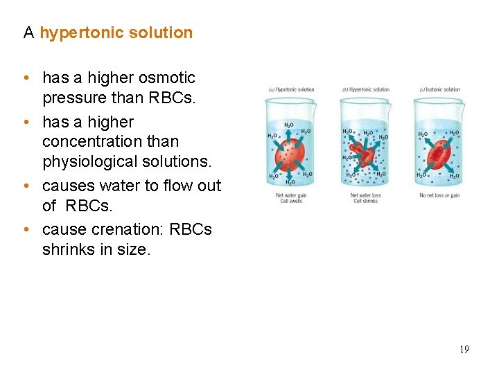 A hypertonic solution Hypertonic Solutions • has a higher osmotic pressure than RBCs. • A hypertonic solution Hypertonic Solutions • has a higher osmotic pressure than RBCs. •