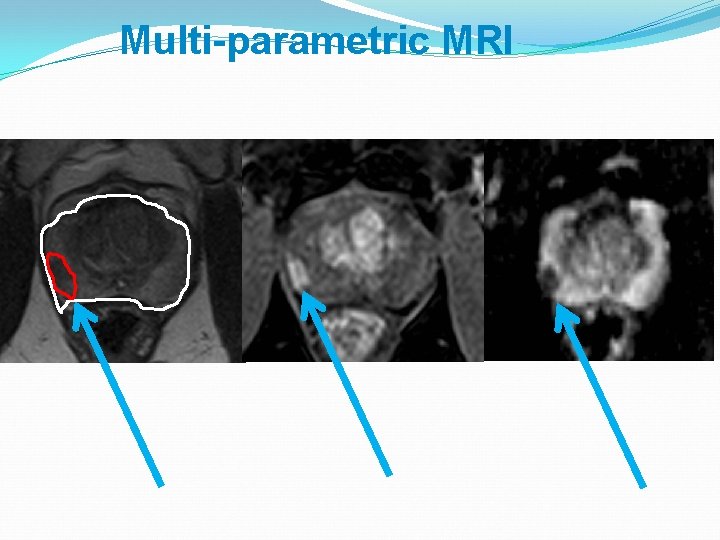 Multi-parametric MRI 