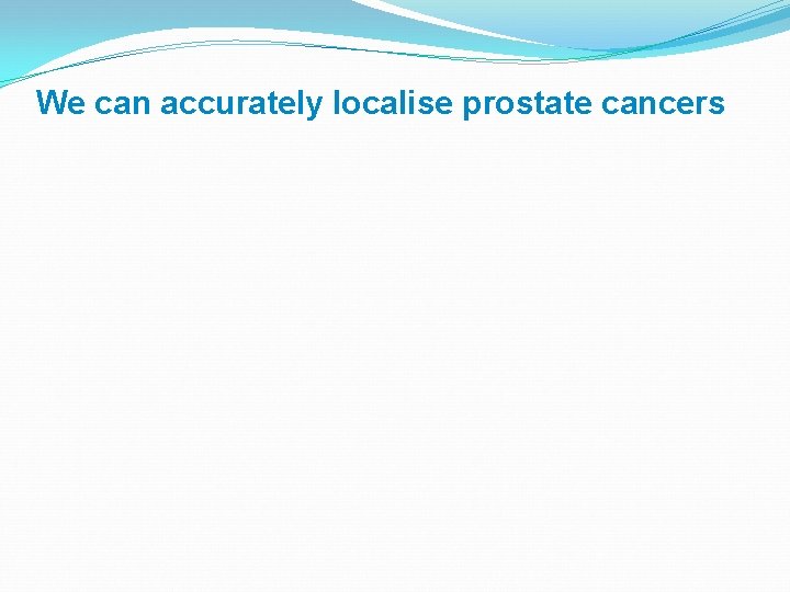 We can accurately localise prostate cancers 
