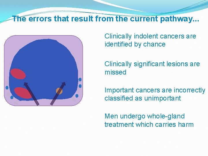 The errors that result from the current pathway. . . Clinically indolent cancers are