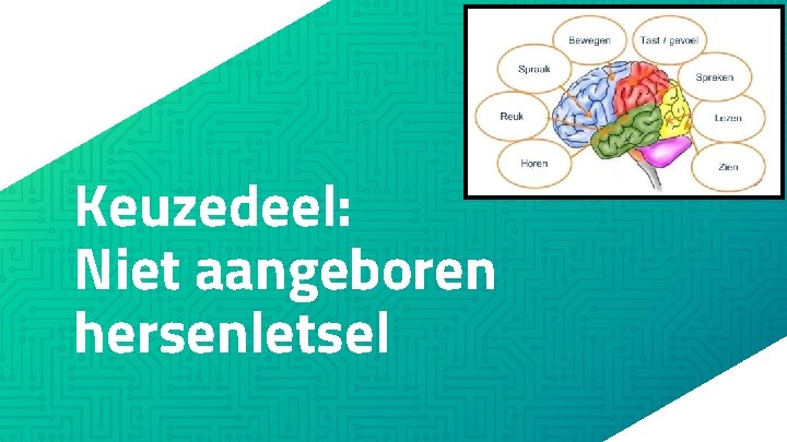 Keuzedeel: Niet aangeboren hersenletsel 