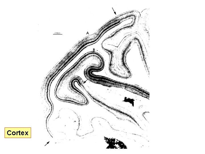 Cortex 