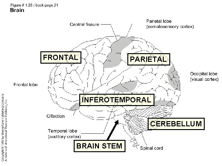 FRONTAL PARIETAL INFEROTEMPORAL CEREBELLUM BRAIN STEM 