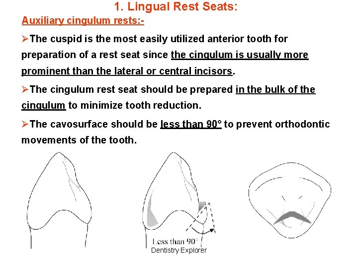 1. Lingual Rest Seats: Auxiliary cingulum rests: - ØThe cuspid is the most easily