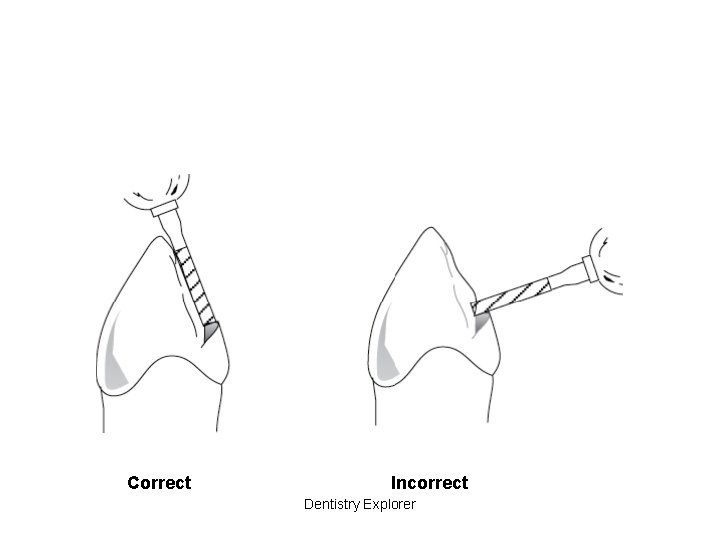 Correct Incorrect Dentistry Explorer 