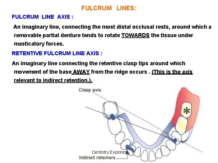 FULCRUM LINES: FULCRUM LINE AXIS : An imaginary line, connecting the most distal occlusal