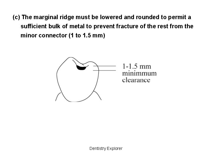 (c) The marginal ridge must be lowered and rounded to permit a sufficient bulk