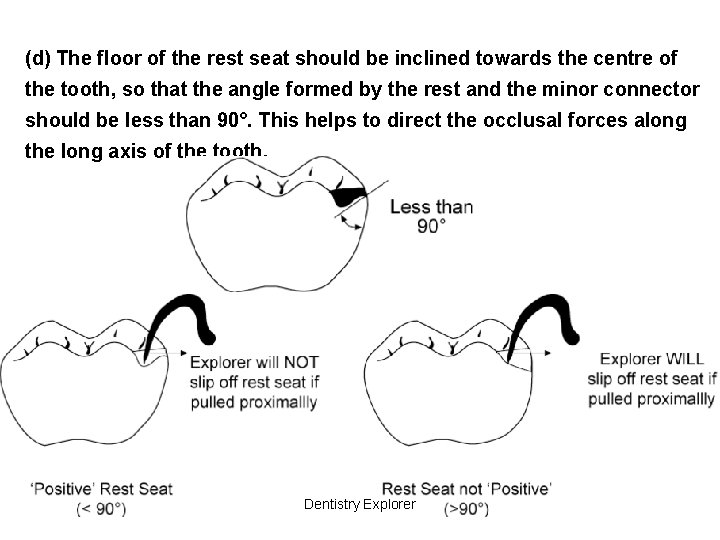 (d) The floor of the rest seat should be inclined towards the centre of