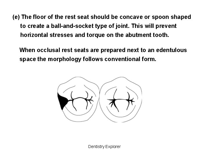 (e) The floor of the rest seat should be concave or spoon shaped to