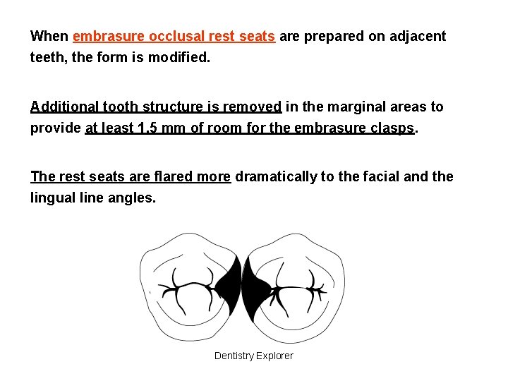 When embrasure occlusal rest seats are prepared on adjacent teeth, the form is modified.