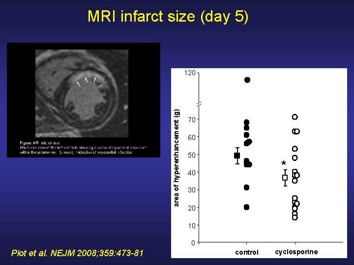 MRI infarct size (day 5) area of hyperenhancement (g) 120 70 60 50 *