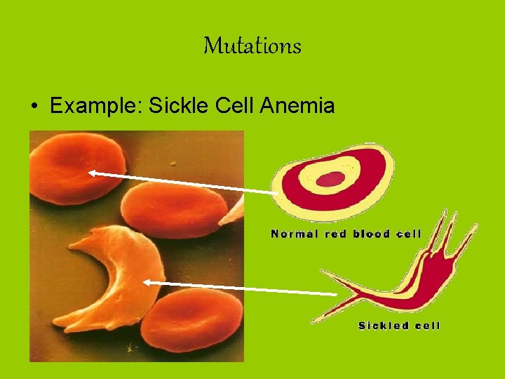 Mutations • Example: Sickle Cell Anemia 