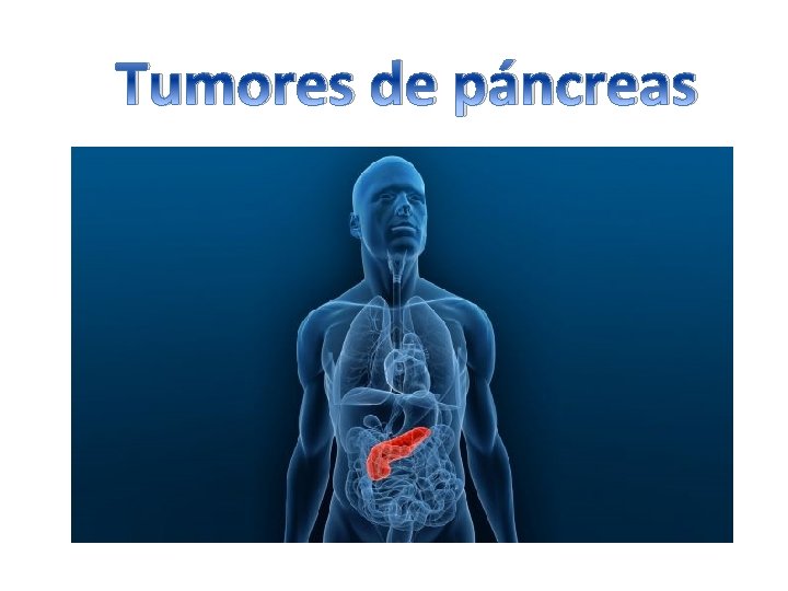 Tumores de páncreas 