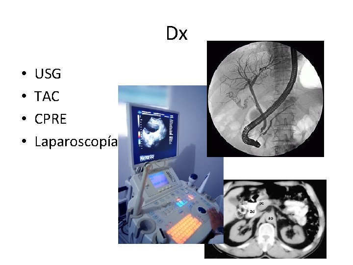 Dx • • USG TAC CPRE Laparoscopía 