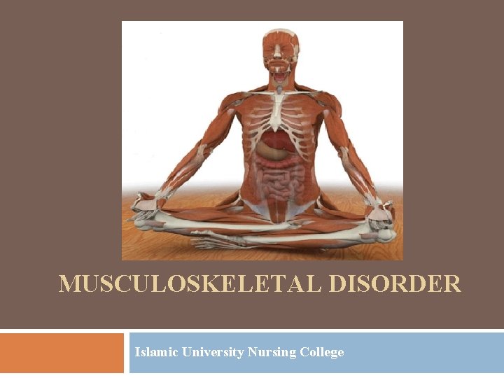 MUSCULOSKELETAL DISORDER Islamic University Nursing College MUSCULOSKELETAL DISORDER Islamic University Nursing College