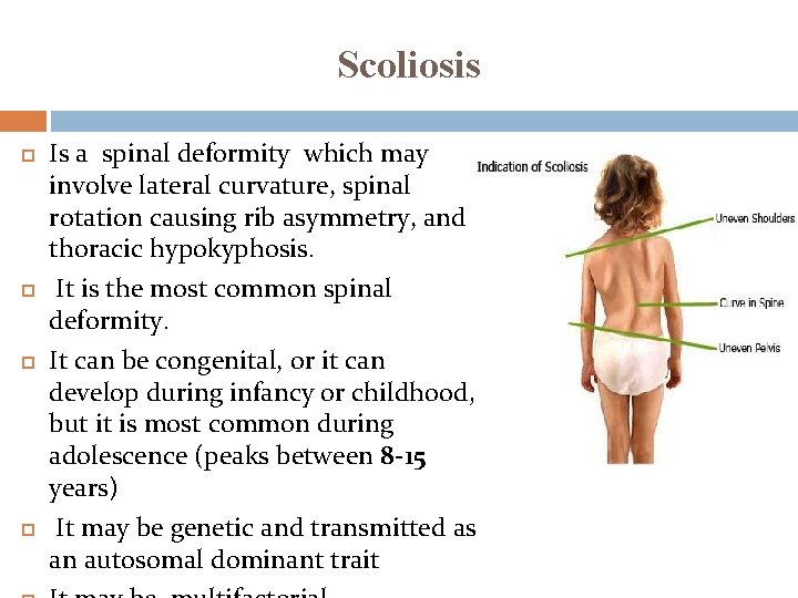 Scoliosis Is a spinal deformity which may involve lateral curvature, spinal rotation causing rib