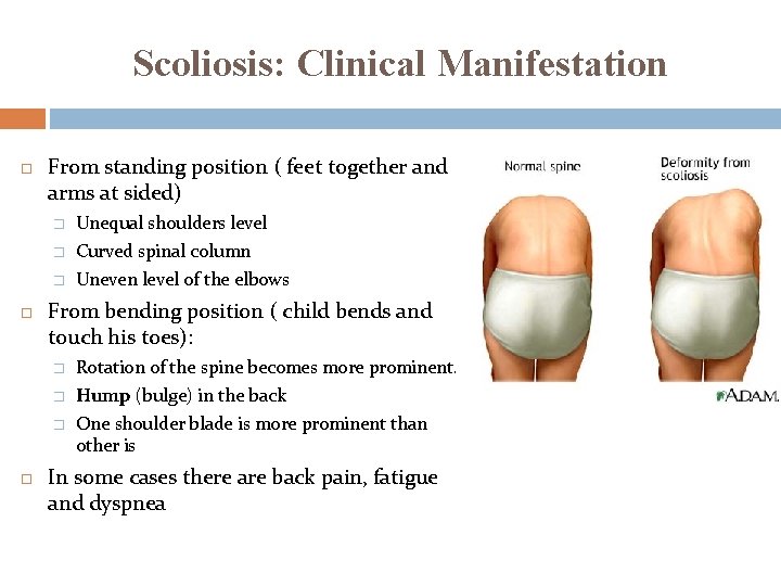 Scoliosis: Clinical Manifestation From standing position ( feet together and arms at sided) � Scoliosis: Clinical Manifestation From standing position ( feet together and arms at sided) �