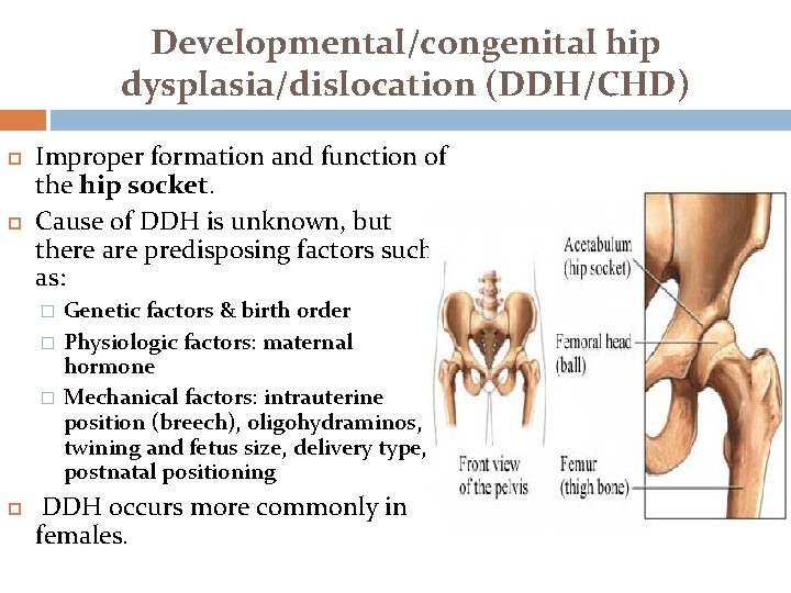 Developmental/congenital hip dysplasia/dislocation (DDH/CHD) Improper formation and function of the hip socket. Cause of Developmental/congenital hip dysplasia/dislocation (DDH/CHD) Improper formation and function of the hip socket. Cause of
