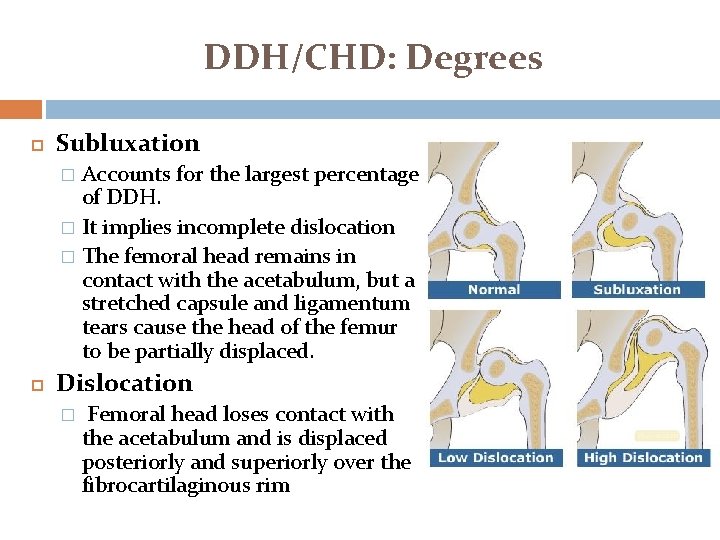 DDH/CHD: Degrees Subluxation Accounts for the largest percentage of DDH. � It implies incomplete DDH/CHD: Degrees Subluxation Accounts for the largest percentage of DDH. � It implies incomplete