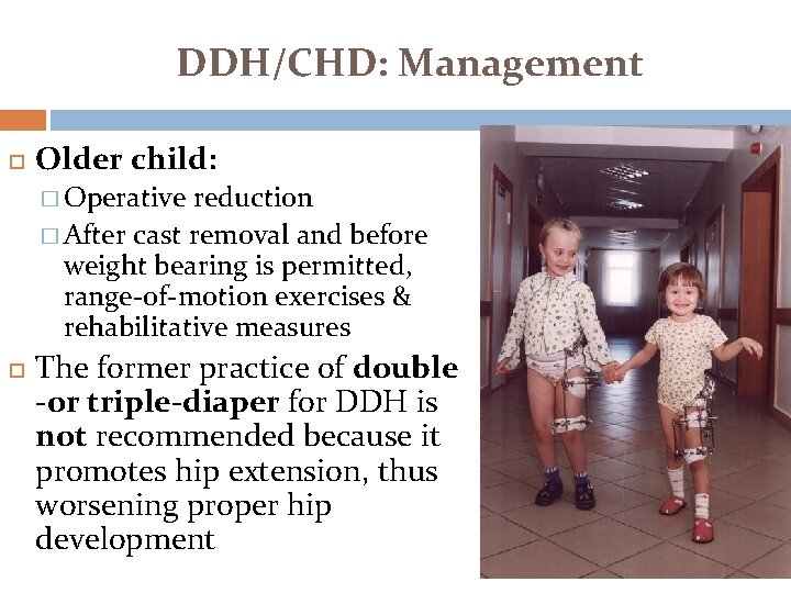 DDH/CHD: Management Older child: � Operative reduction � After cast removal and before weight DDH/CHD: Management Older child: � Operative reduction � After cast removal and before weight