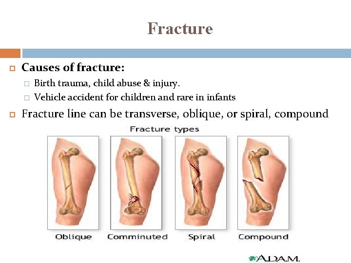 Fracture Causes of fracture: � � Birth trauma, child abuse & injury. Vehicle accident Fracture Causes of fracture: � � Birth trauma, child abuse & injury. Vehicle accident
