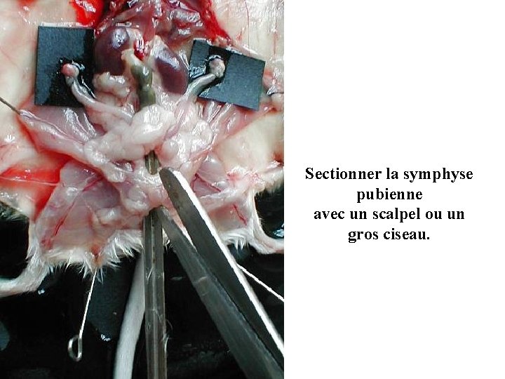 Sectionner la symphyse pubienne avec un scalpel ou un gros ciseau. 